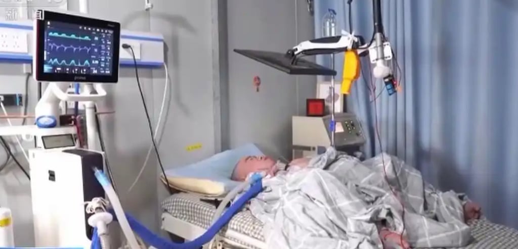 Li Xia lies in his hospital bed. He relies on a ventilator to keep him alive. Photo: CCTV