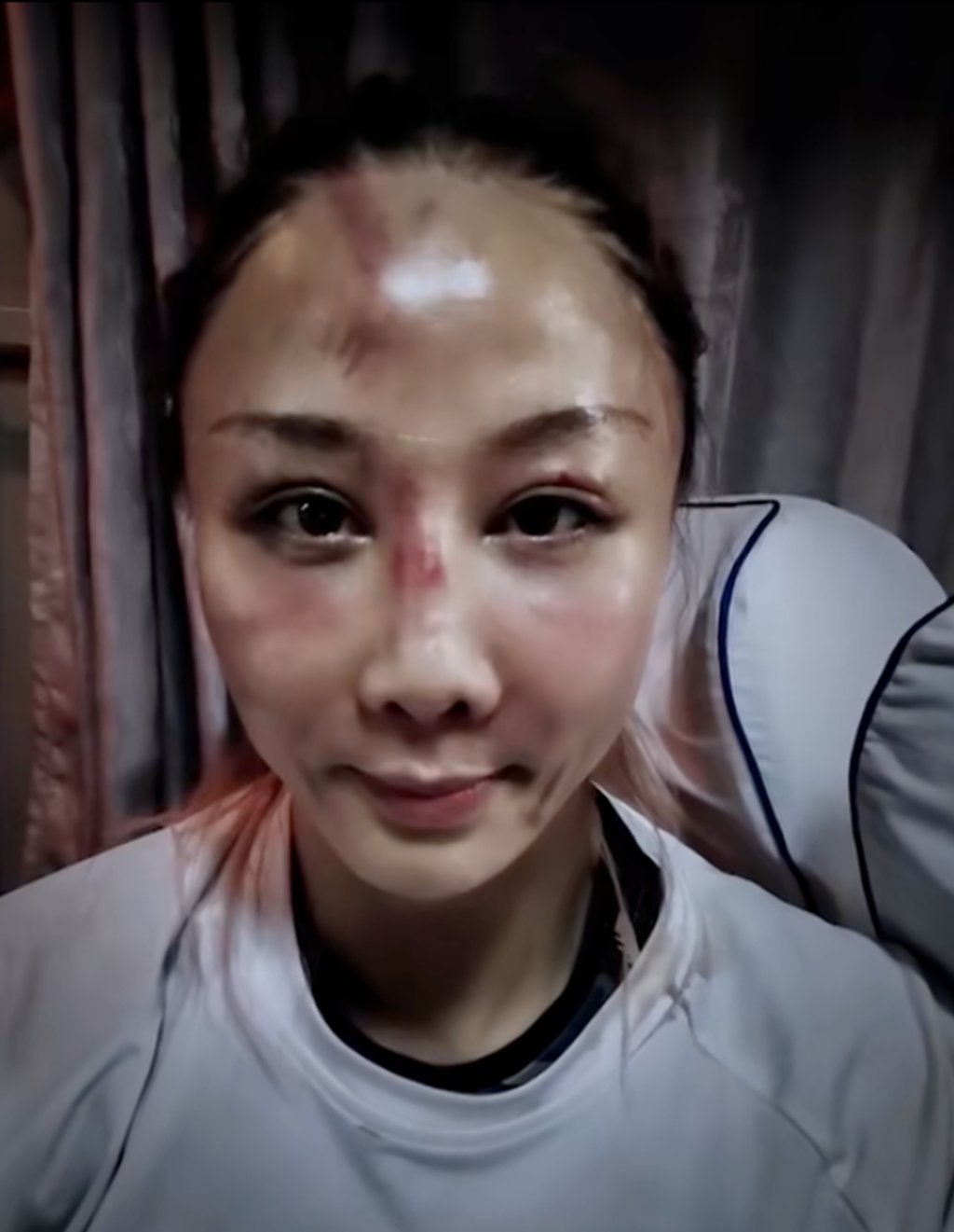 Despite frequently facing injuries, Ding remains committed to her training regimen without interruption. Photo: QQ.com