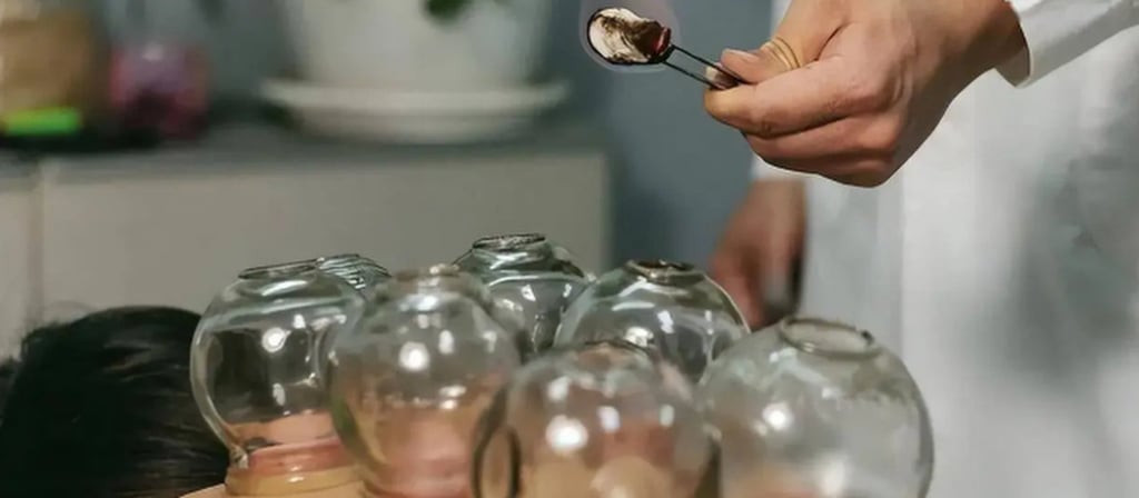 Cupping therapy taking place. The treatment is used to alleviate pain and stiffness. Photo: Sohu