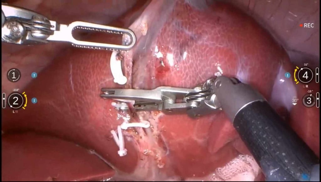 The robot autonomously performed complex surgery on a pig. Photo: Handout
