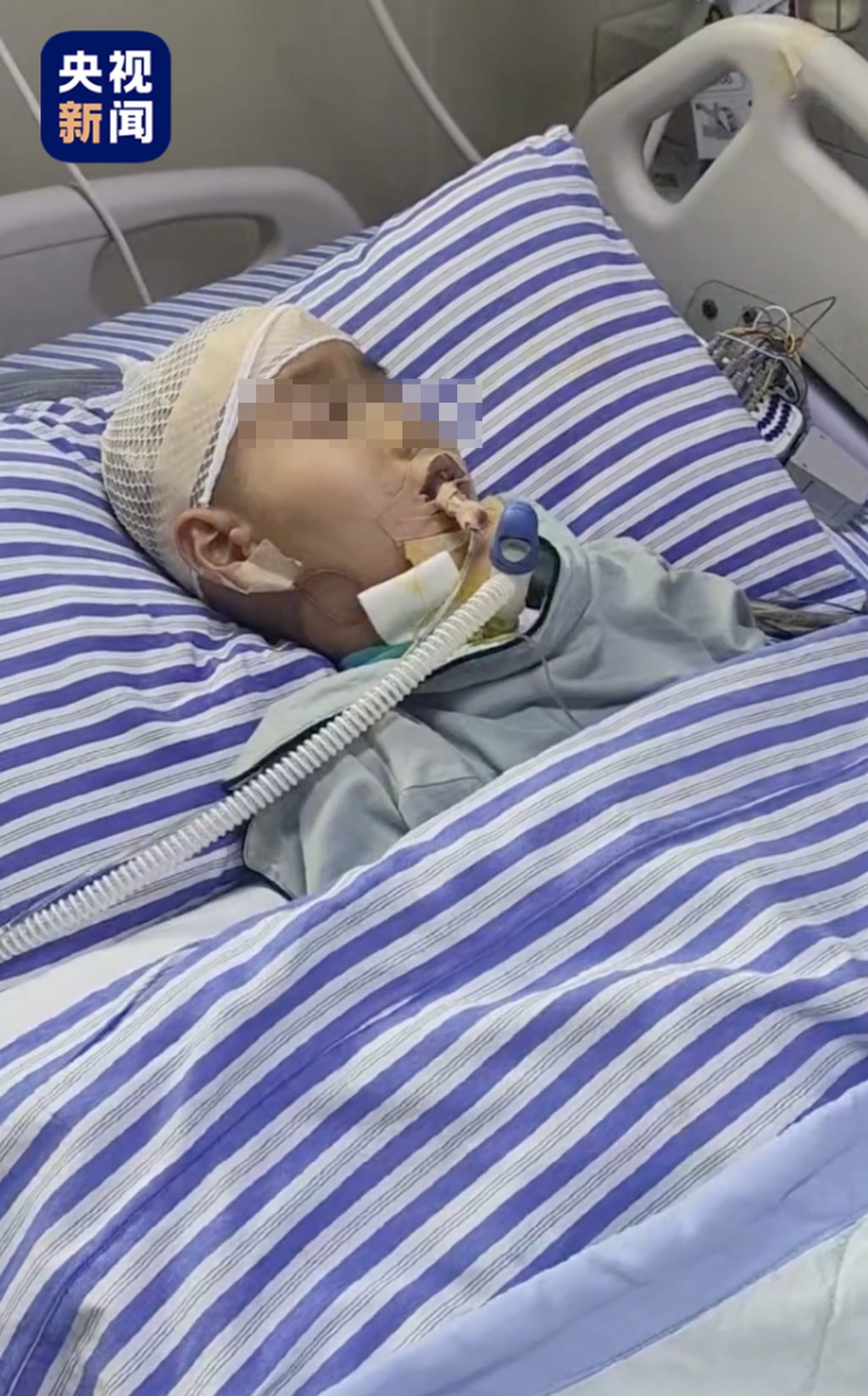 Liu Chuxi in his hospital bed. The youngster suffered brain damage in the accident. Photo: CCTV