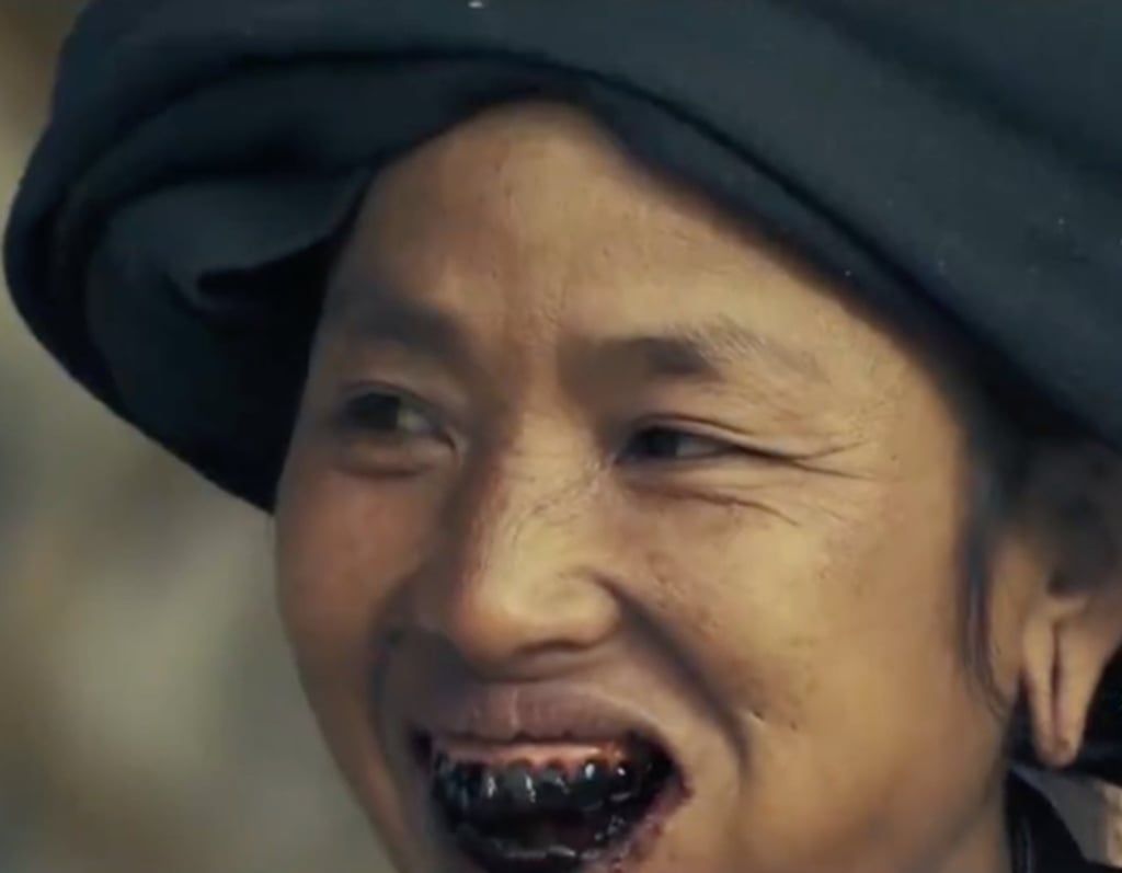 A Bulang woman with heavily blackened teeth smiles for the camera. Photo: pearvideo A Bulang woman with heavily blackened teeth smiles for the camera. Photo: pearvideo