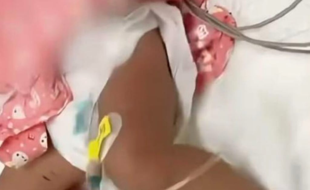 Doctors were horrified to discover the extent of the infant boy’s injuries above. Photo: QQ.com Doctors were horrified to discover the extent of the infant boy’s injuries above. Photo: QQ.com