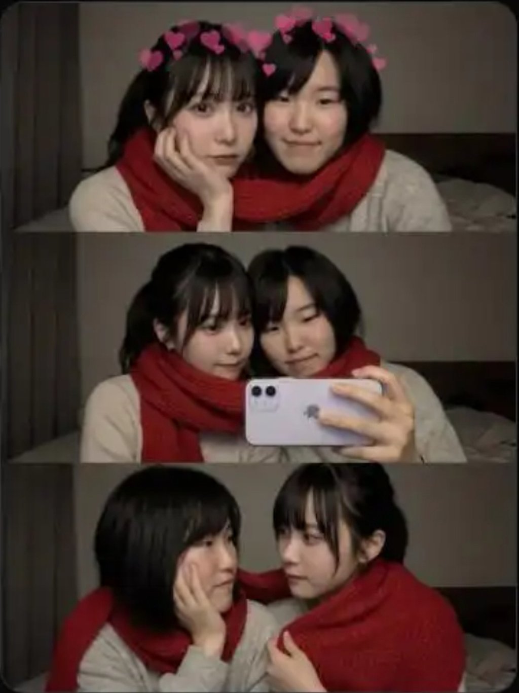 A imagem acima mostra uma imagem gerada por IA da mesma pessoa antes e depois da cirurgia estética. Foto de : Bedou