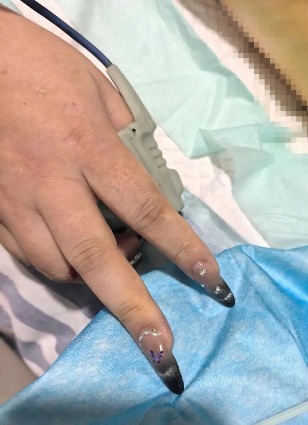 Lili’s fake nails, above, presented a dangerous impediment to her emergency treatment. Photo: Handout Lili’s fake nails, above, presented a dangerous impediment to her emergency treatment. Photo: Handout