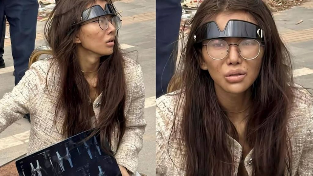 Umi, above, was found near a Cambodian hotel, looking gaunt and dirty, holding a CAT scan and suffering from a leg injury. Photo: RedNote