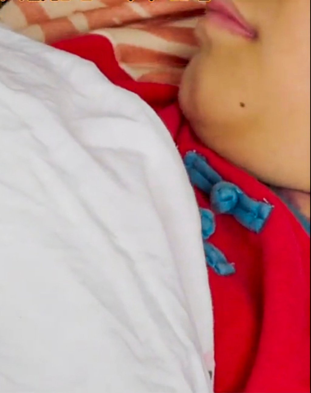 Little Xiaoliang, above, lies in his hospital bed before undergoing the operation. Photo: QQ.com