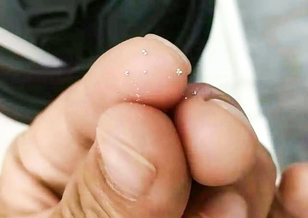 The woman found tiny metal slivers, like those above, in her cup of tea. Photo: Weibo