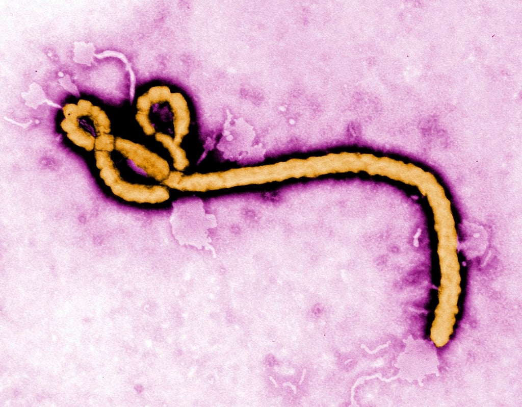 The Ebola virus is very contagious and can be contracted through bodily fluids such as vomit, blood and semen. Photo: CDC via AP
