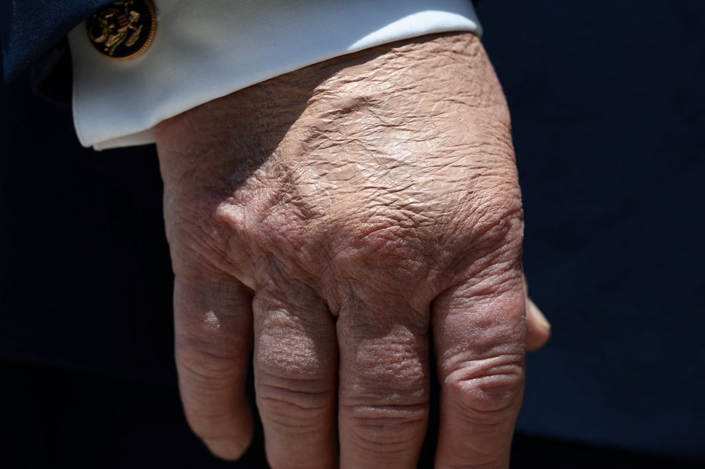Make-up partially covering US President Donald Trump’s hand. Photo: Reuters