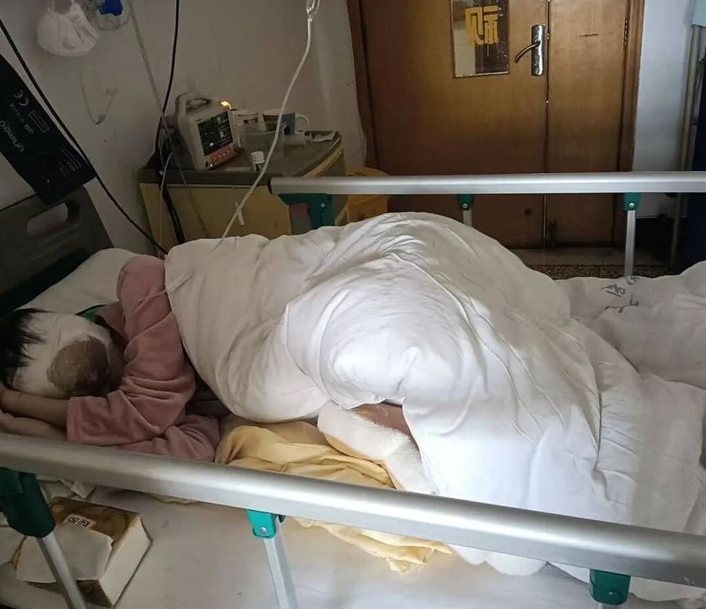 চীনা মহিলা চোখের প্যাচ, আংশিক দৃষ্টি পরে মুখোশ, ক্যান্সার থেকে চোয়াল হারানো সঙ্গে নাচ