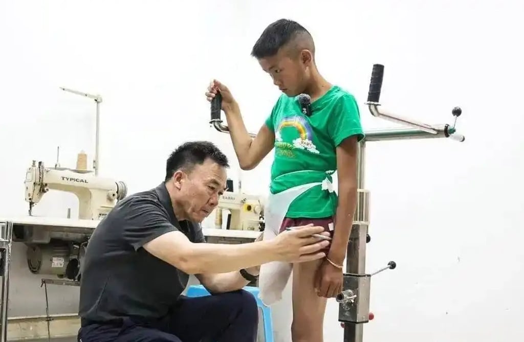A prosthetic limb expert measures up Apei for his artificial leg. Photo: Handout A prosthetic limb expert measures up Apei for his artificial leg. Photo: Handout