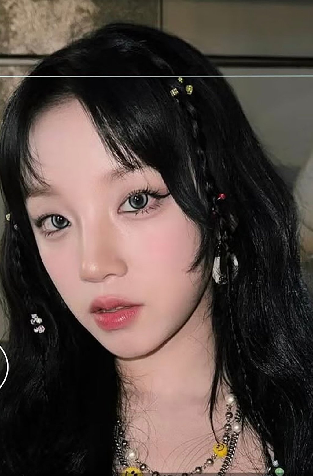A young woman, above, pictured after her beauty treatment. Photo: instagram/mdgirl_kr A young woman, above, pictured after her beauty treatment. Photo: instagram/mdgirl_kr
