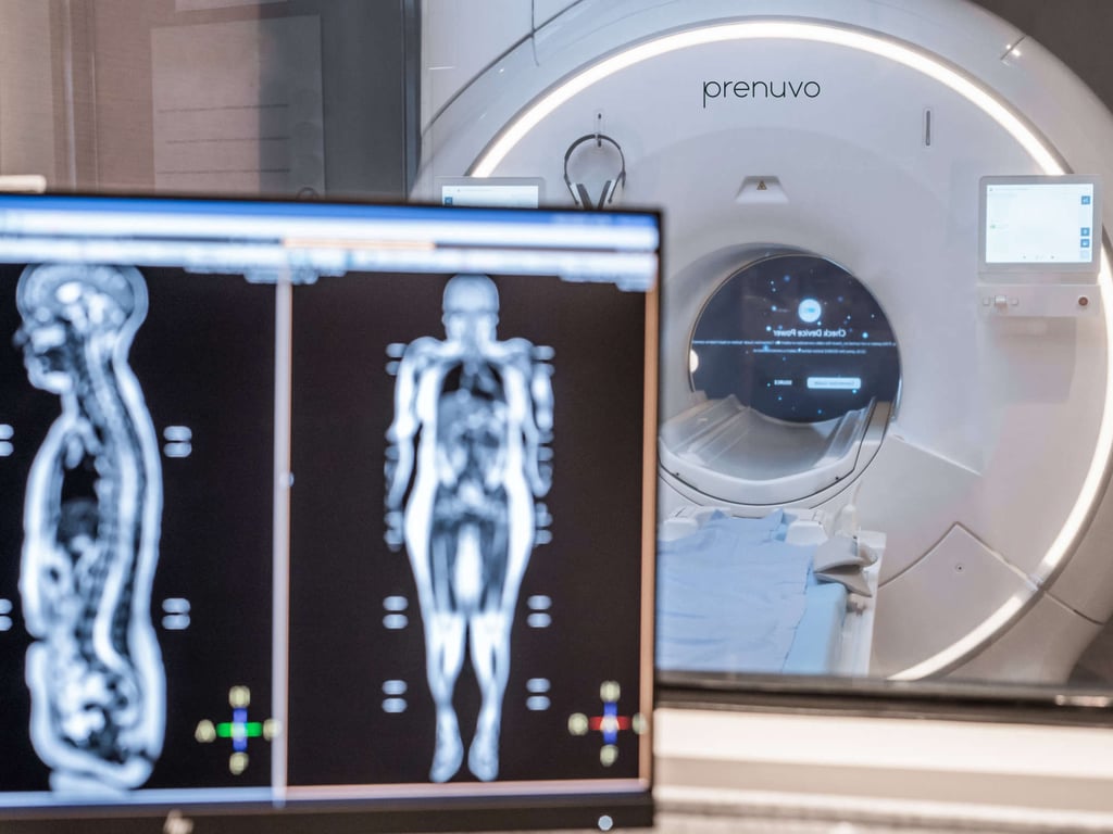 Prenuvo full-body scans. Photo: Handout