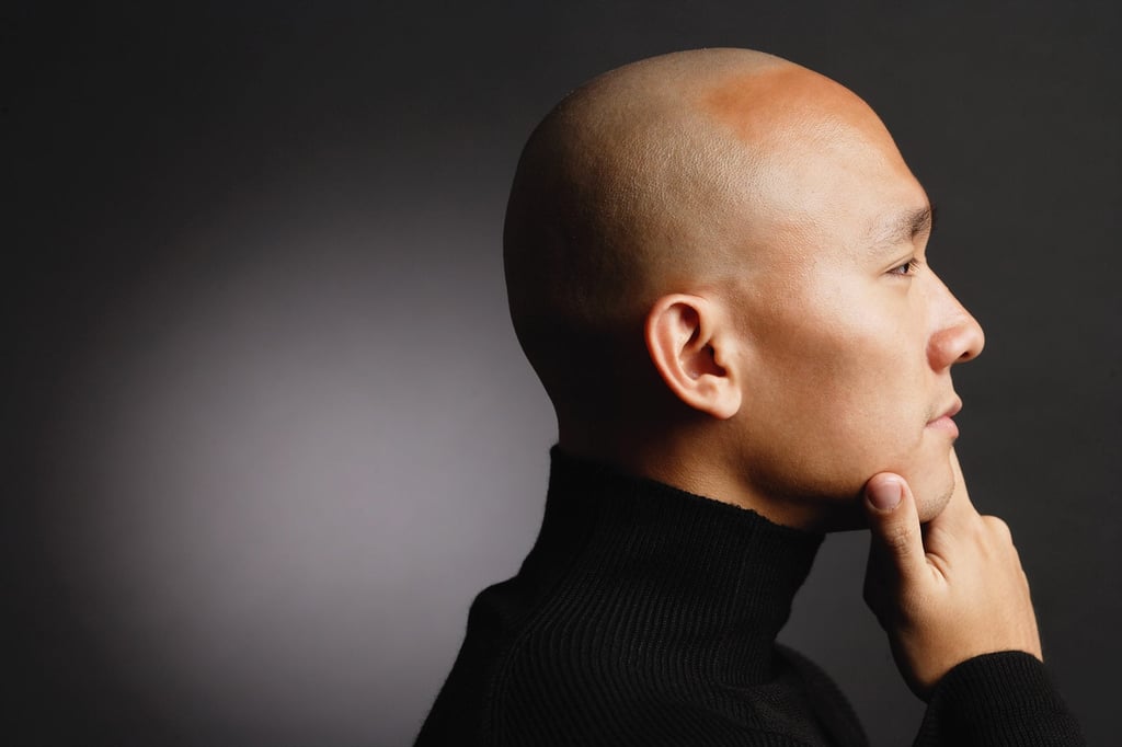 Li had been wanting to have a normal scalp for years — much like the man pictured above — having suffered from severe psychological stress and confidence issues since his teenage years. Photo: Shutterstock Li had been wanting to have a normal scalp for years — much like the man pictured above — having suffered from severe psychological stress and confidence issues since his teenage years. Photo: Shutterstock