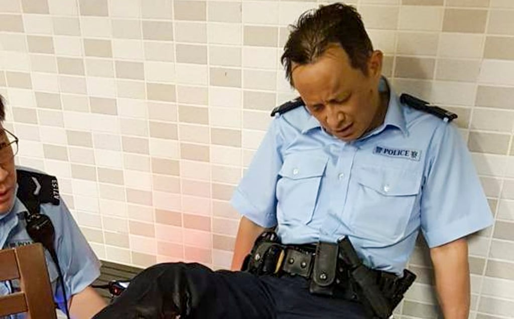 A policeman was bitten in the right calf by a wild boar in November 2021. Photo: Facebook