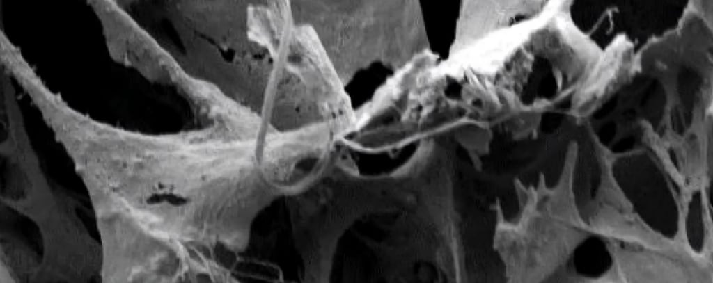 An electron microscope image shows the small openings that researchers dubbed “arachnoid fenestrations”. Photo: Handout