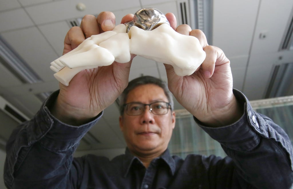Edmond Yau, founder and CEO of Koln 3D, with a tailor-made talar metal implant at HKSTP. Photo: Jonathan Wong Edmond Yau, founder and CEO of Koln 3D, with a tailor-made talar metal implant at HKSTP. Photo: Jonathan Wong