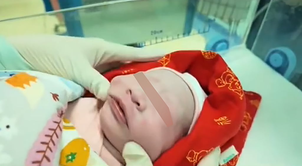 Weighing 2.8kg, the infant girl was delivered via C-section on September 17 at Zhumadian Central Hospital in central China’s Henan province. Photo: The Paper Weighing 2.8kg, the infant girl was delivered via C-section on September 17 at Zhumadian Central Hospital in central China’s Henan province. Photo: The Paper