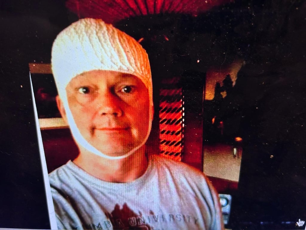 Jeff Kingston, a Tokyo-based US academic, was attacked by a bear in Gunma, Japan, in 2014. Photo: Jeff Kingston