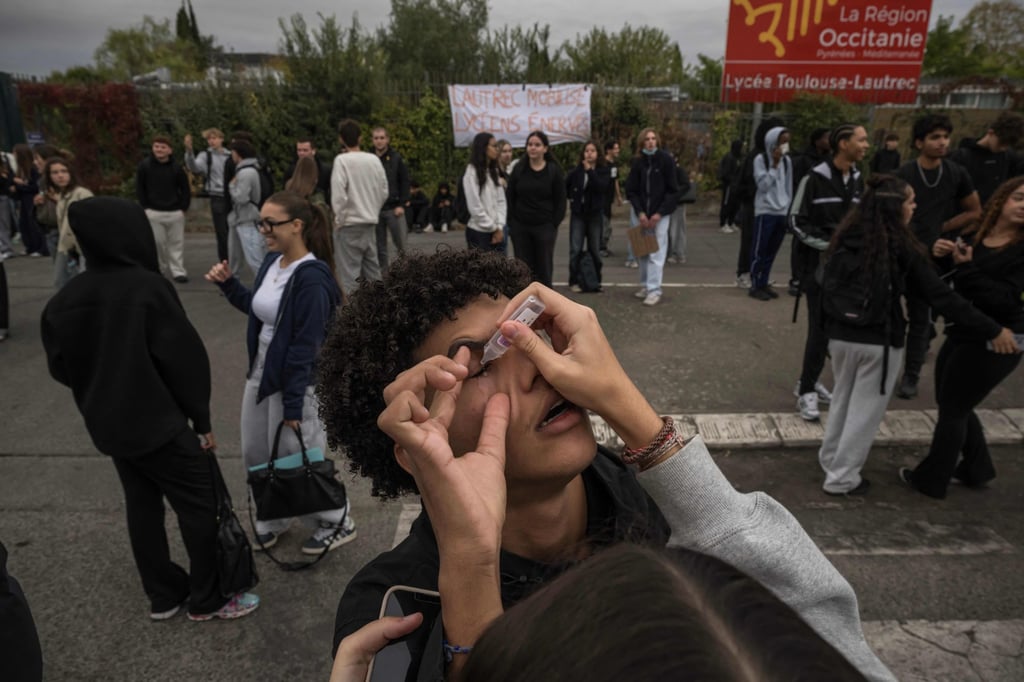 A youth receives eye drops after French riot police used tear gas to disperse protesters during a demonstration in Toulouse on Monday. Photo: AFP