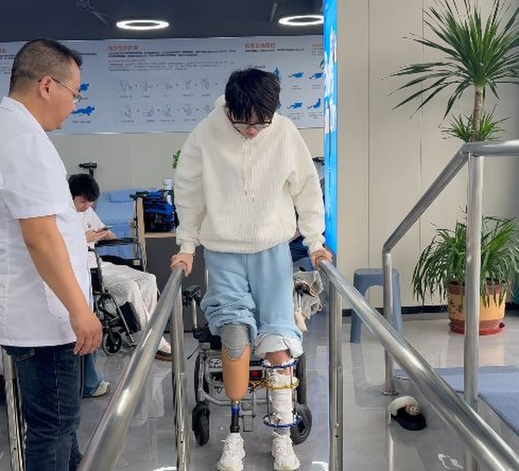 The extensive injuries of @wananan included multiple bone fractures, an intracranial haemorrhage, damage to her cervical spine and internal organs, and the amputation of her lower right leg. Photo: 163.com The extensive injuries of @wananan included multiple bone fractures, an intracranial haemorrhage, damage to her cervical spine and internal organs, and the amputation of her lower right leg. Photo: 163.com