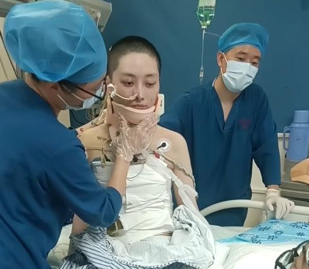 It took 14 hours of emergency surgery to save her life, followed by 50 days in the intensive care unit; however, her attending doctor noted that the treatment was successful beyond all expectations. Photo: 163.com It took 14 hours of emergency surgery to save her life, followed by 50 days in the intensive care unit; however, her attending doctor noted that the treatment was successful beyond all expectations. Photo: 163.com