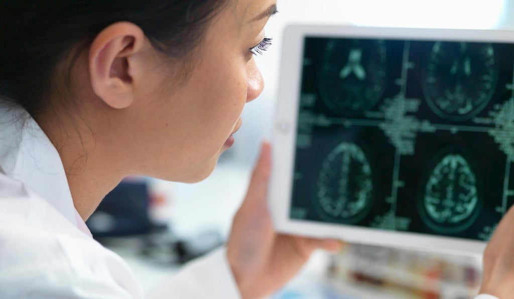 A CAT scan can reveal brain abnormalities. Photo: Alamy