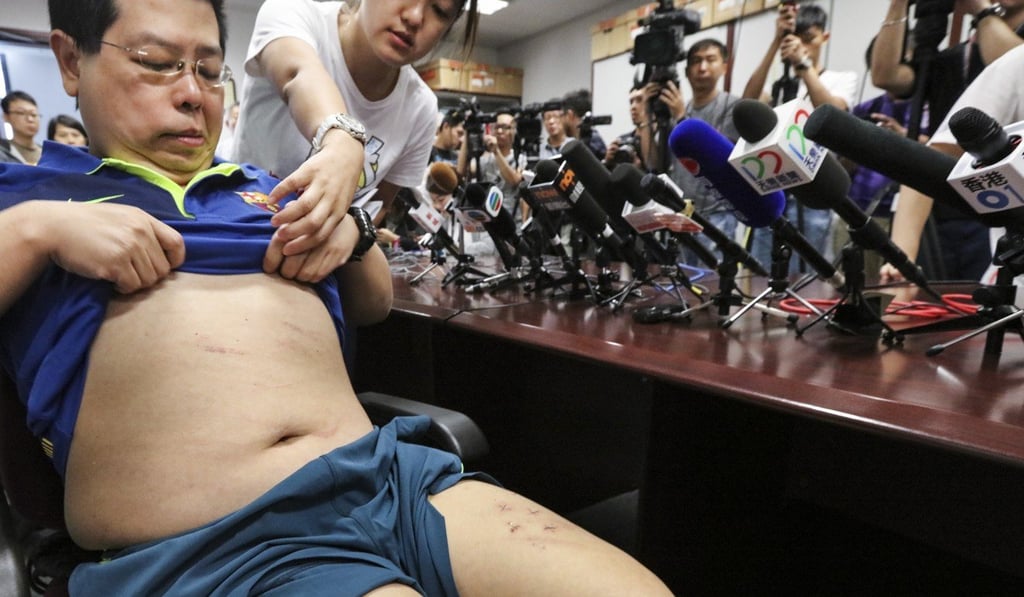Howard Lam shows the media wounds he claims were caused by mainland agents. Photo: Felix Wong