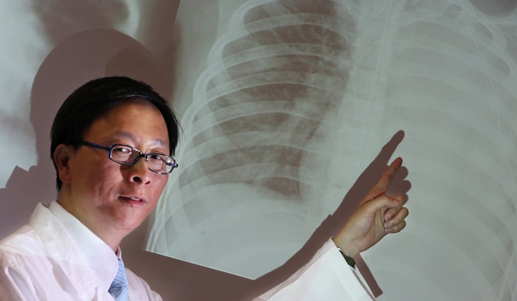 Dr Ho Pak-leung said the rise in the number of measles cases was due to people bringing the disease to the city from abroad. Photo: SCMP Pictures