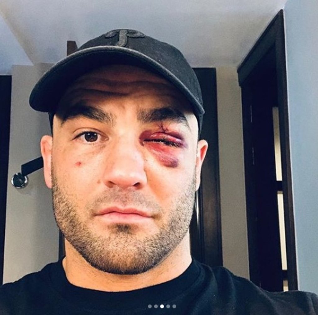 Eddie Alvarez says he will bounce back from his Tokyo defeat.