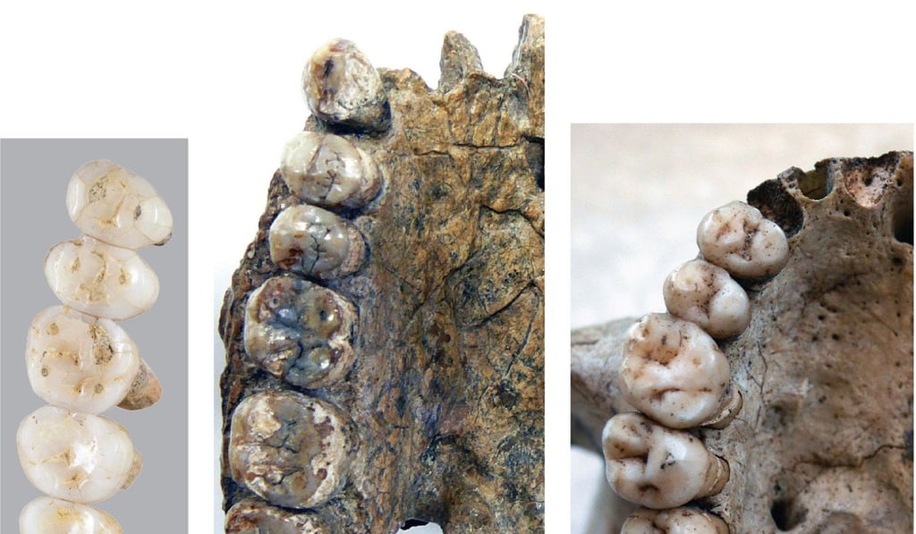 Photos taken on March 15 compare the fossil teeth of the newly discovered species Homo luzonensis and that of Errectus Sapiensa. Photo: AFP/Florent Detroit