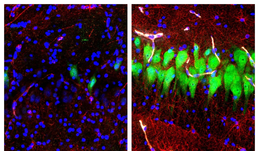 Stained microscope photos of a pig brain left untreated for 10 hours after death (left) and another with a specially designed blood substitute pumped through it. Photo: AP/Yale School of Medicine Stained microscope photos of a pig brain left untreated for 10 hours after death (left) and another with a specially designed blood substitute pumped through it. Photo: AP/Yale School of Medicine