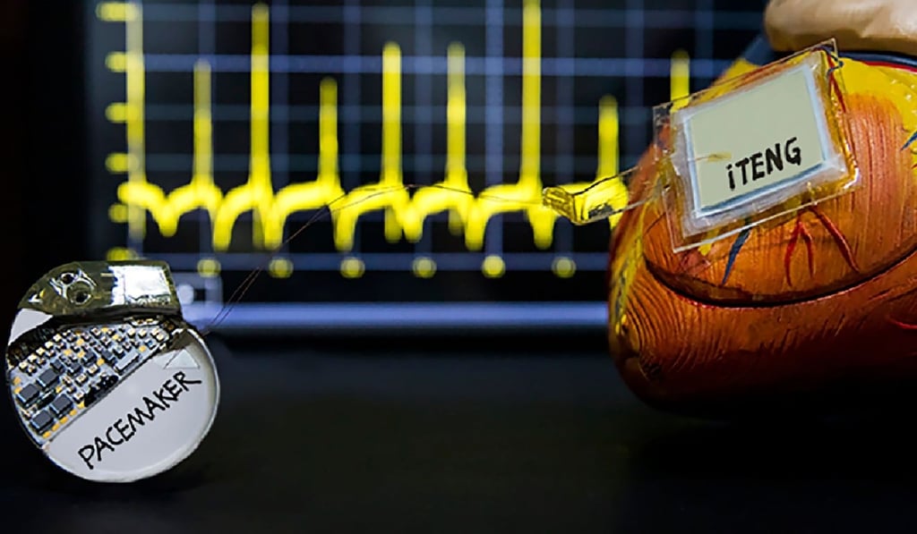 The device, as seen in a photo made available on Tuesday, is able to generate its own energy from heartbeats to power a cardiac pacemaker. Photo: Beijing Institute of Nanoenergy and Nanosystems, Chinese Academy of Sciences/Nature Press Service via AFP
