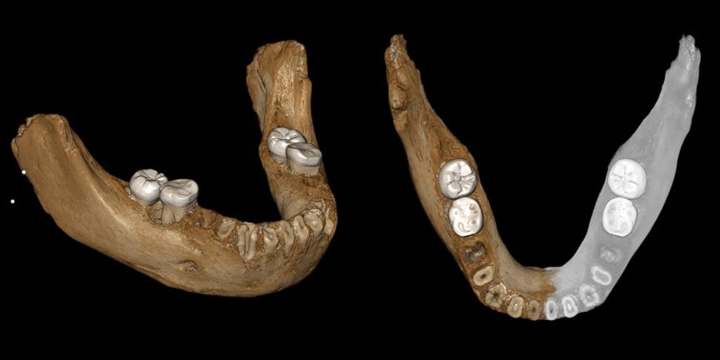 An ancient Sherpa relative? 160,000-year-old jawbone found