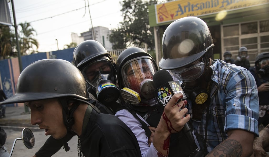 People assist an injured member of the media during clashes between protesters and members of the National Bolivarian Armed Forces after an attempted military uprising in Altamira, Caracas. Photo: Bloomberg