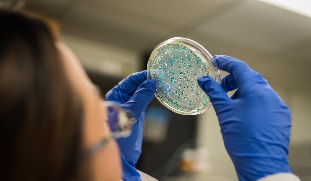 A researcher studies gut bacteria in a laboratory. The health of the body’s microbiome is linked to mental health, research has shown. Photo: Alamy A researcher studies gut bacteria in a laboratory. The health of the body’s microbiome is linked to mental health, research has shown. Photo: Alamy