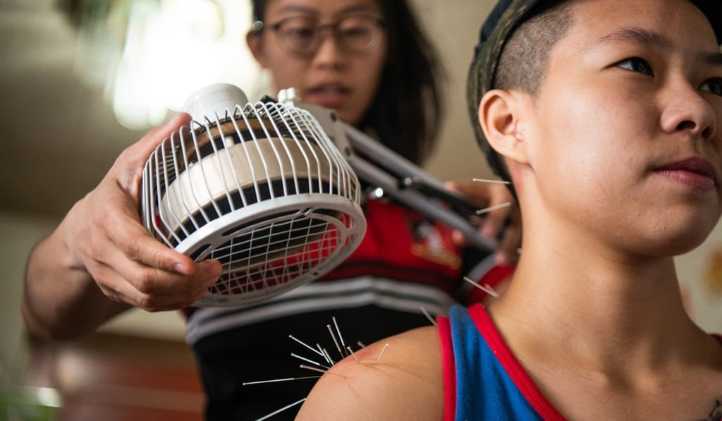 Toto Cheng applies a heat lamp to acupuncture needles she is using on a client, rugby player Myron Ng. Photo: Laurel Chor Toto Cheng applies a heat lamp to acupuncture needles she is using on a client, rugby player Myron Ng. Photo: Laurel Chor