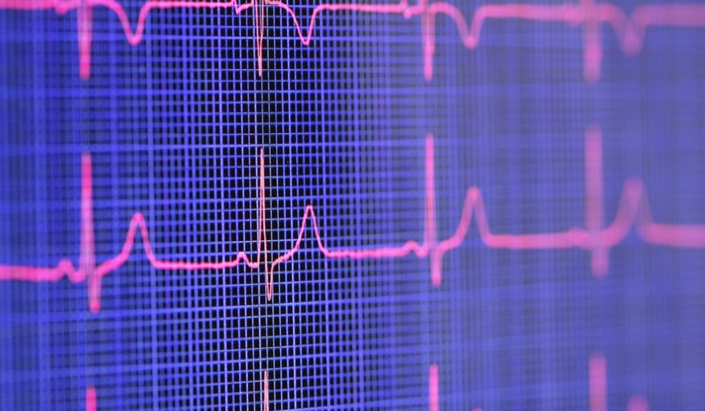 Biofourmis expects its digital therapeutics software platform to come in handy for people suffering from cardiovascular disease in China. Photo: Corbis