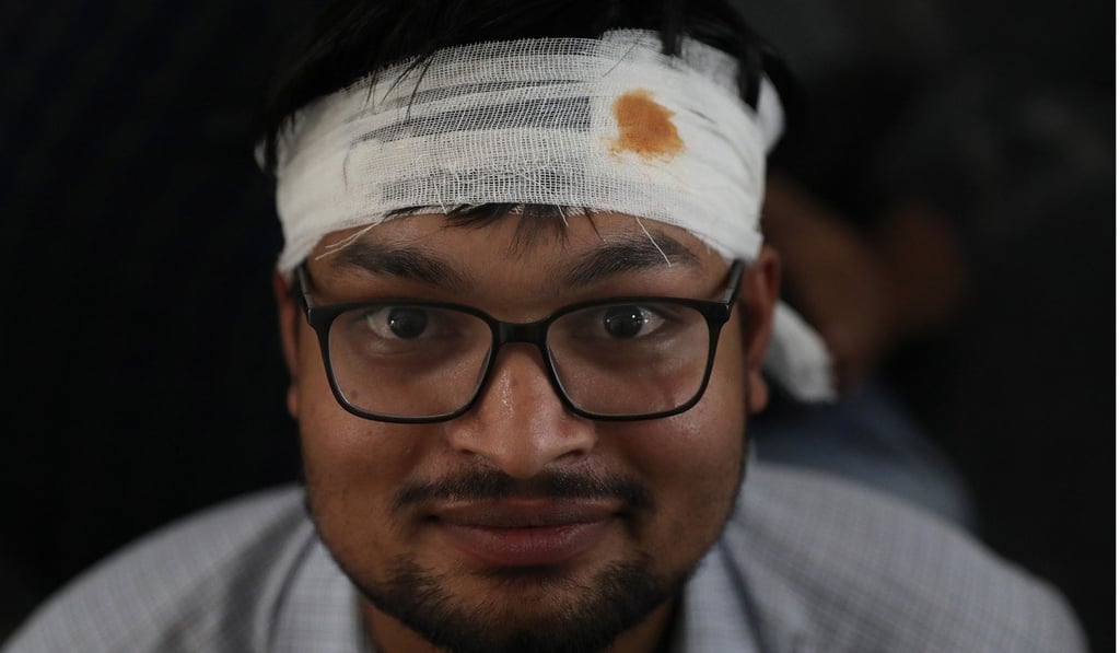 A resident doctor with a bandage on his head takes part in a protest in New Delhi. Photo: EPA-EFE