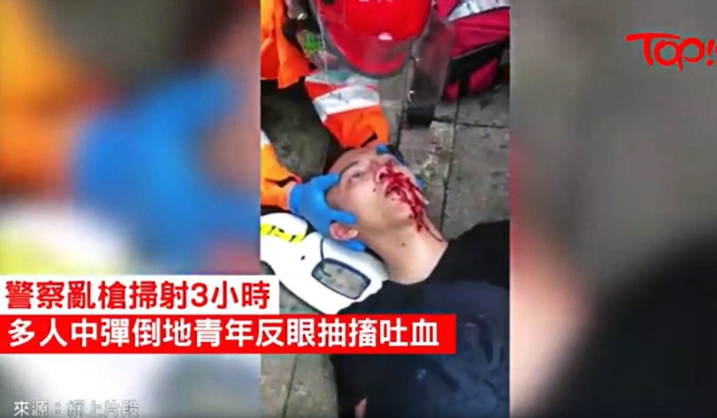 A video that has gone viral on social media shows a secondary school student in Hong Kong who was shot in the face with a tear-gas canister. Photo: YouTube
