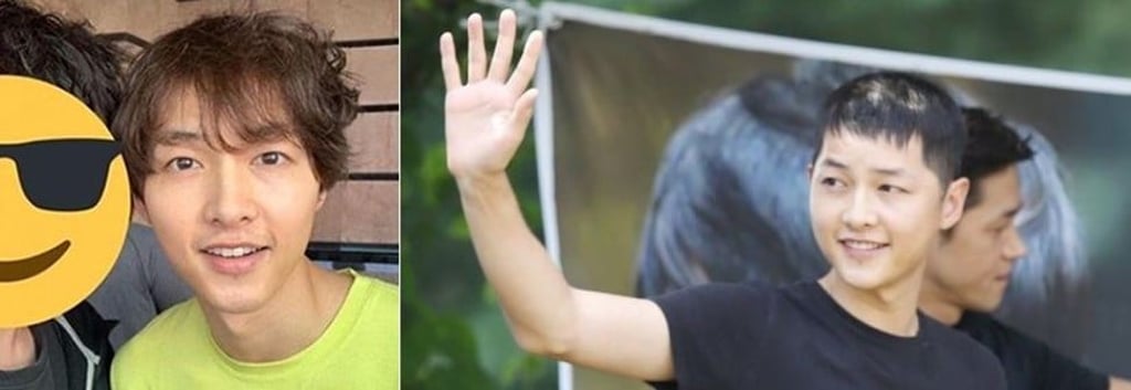 Two photographs, published on Monday, of South Korean actor Song Joong-ki, which suggest he may be suffering from hair loss.