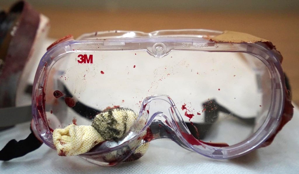 Goggles worn by the girl who suffered a serious eye injury during anti-government protests. Photo: QR Goggles worn by the girl who suffered a serious eye injury during anti-government protests. Photo: QR