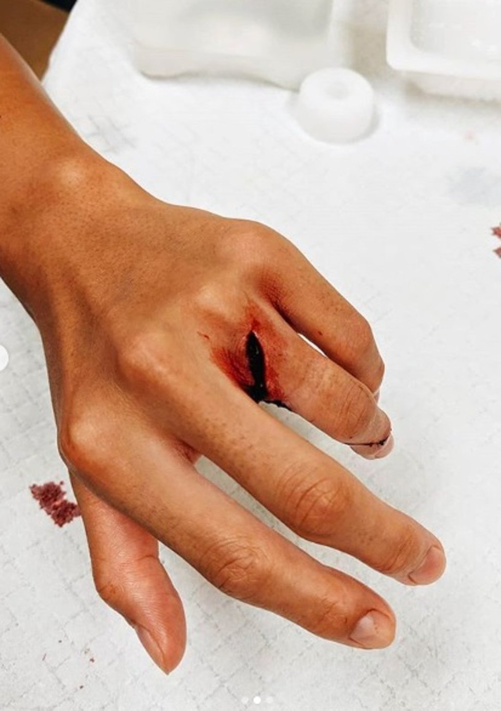 Angela Lee shows off her wound before she receives stitches. Photo: Instagram/Angela Lee