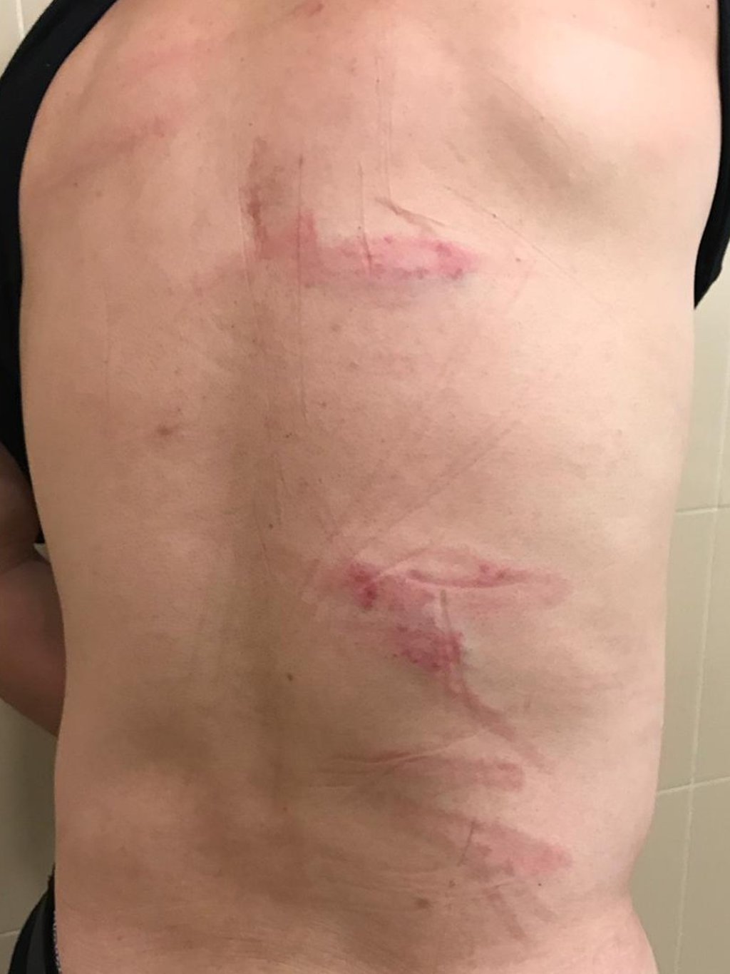 Leung Kam-shing was beaten with what he described as long, thin wooden sticks. Photo: Max Chung