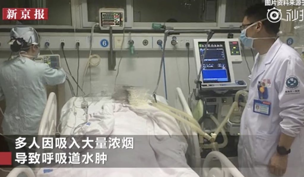 A survivor is treated on a ventilator by doctors after a truck caught fire in a motorway tunnel and spewed choking smoke. Photo: Miaopai