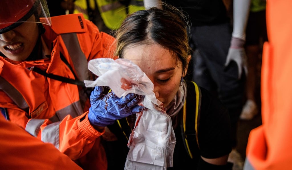 The woman was hurt during a protest in Tsim Sha Tsui on August 11. Photo: AFP