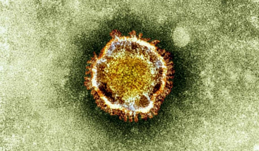 An undated electron microscope image of a coronavirus, part of a family of viruses that cause ailments including the common cold and Sars. Image: British Health Protection Agency via AP