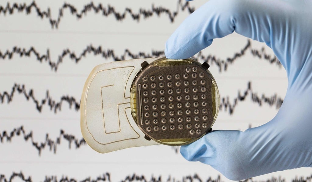 A French scientist holds an implant placed between the brain and skin which reads the area of the brain which controls movement. Photo: AFP