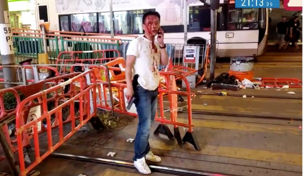 The plain-clothes officer was attacked in Yuen Long after protesters realised he was police. Photo: Handout